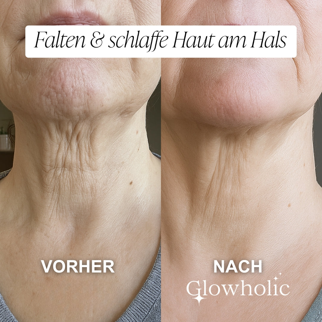 Schweizer Anti-Falten Starter Set - Glowholic Micro-Needling-Infusion