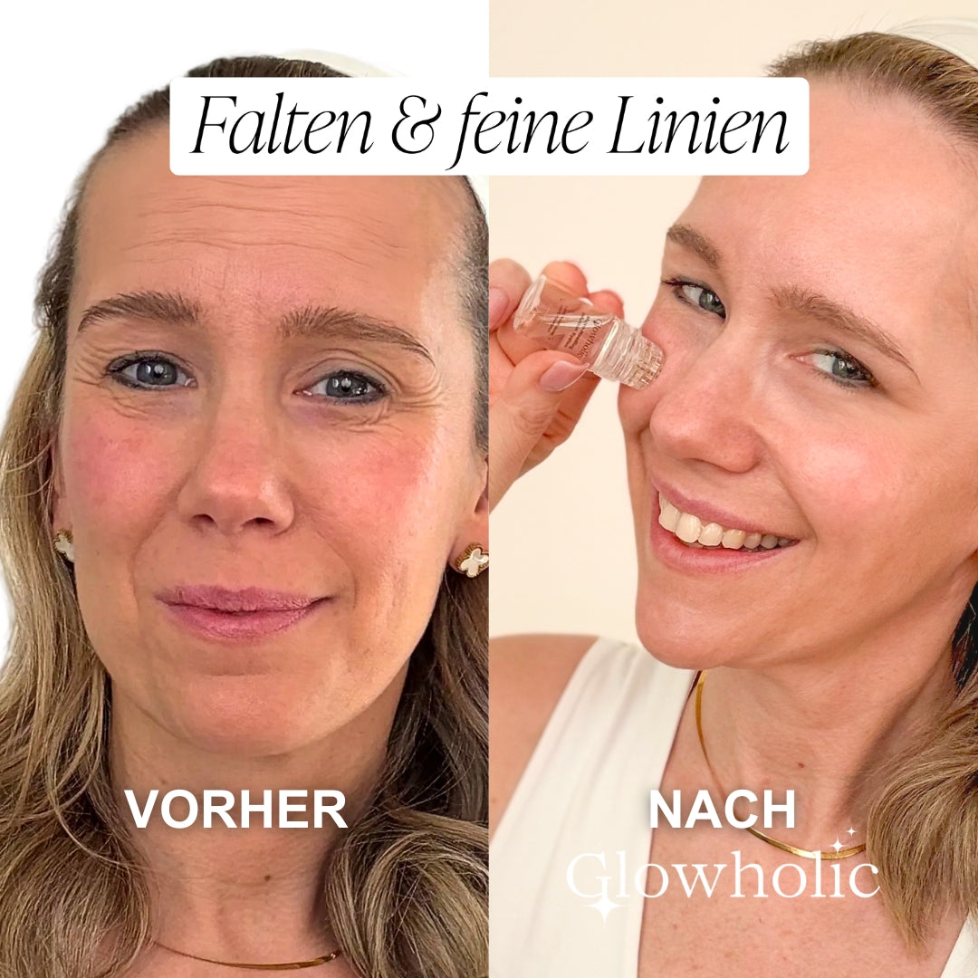 Schweizer Anti-Falten Starter Set - Glowholic Micro-Needling-Infusion