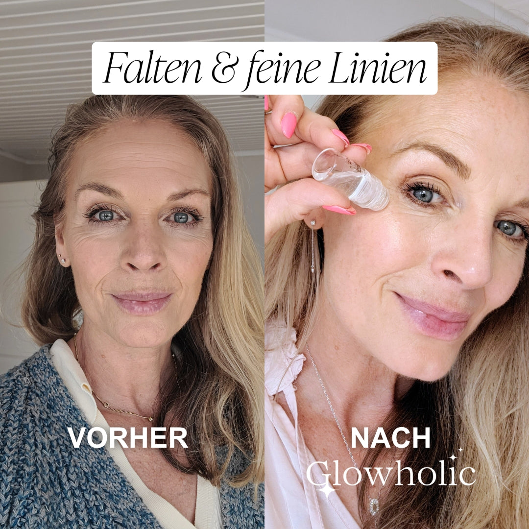 Schweizer Anti-Falten Starter Set - Glowholic Micro-Needling-Infusion