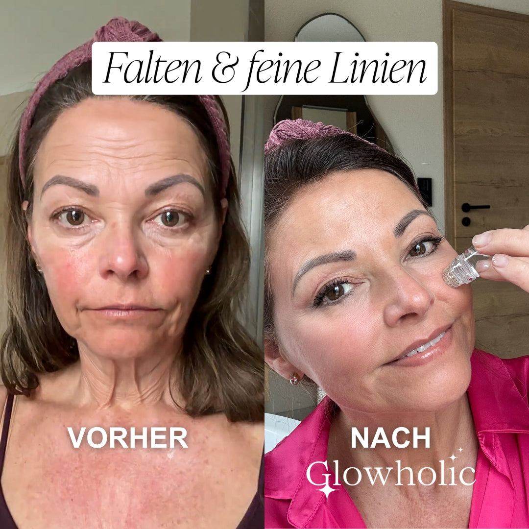 Schweizer Anti-Falten Starter Set - Glowholic Micro-Needling-Infusion